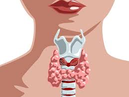 Thyromegaly